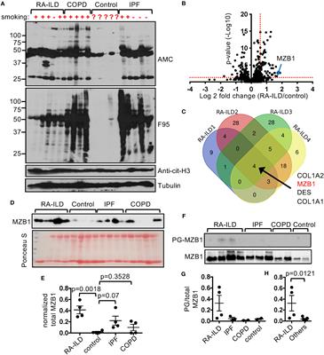 Peptidylarginine deiminase 2 citrullinates MZB1 and promotes the secretion of IgM and IgA